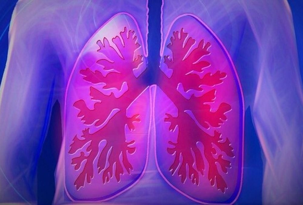 Lung Cancer